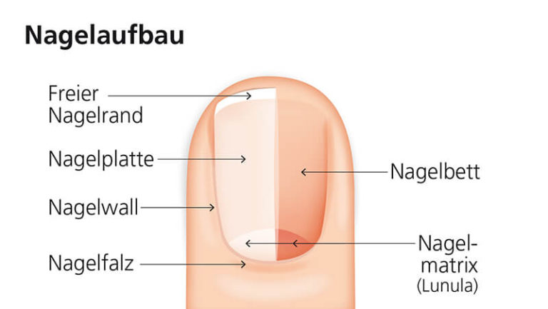 Wo Kommen Belage Nagel Zum Einsatz