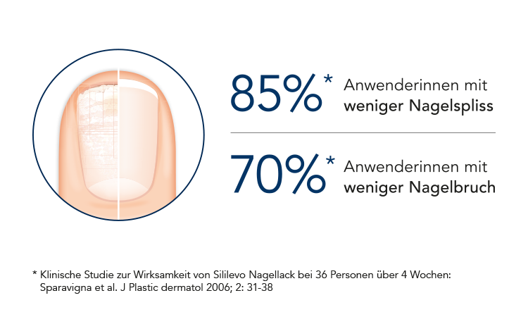 Statistik zum Nagelbruch (Grafik)