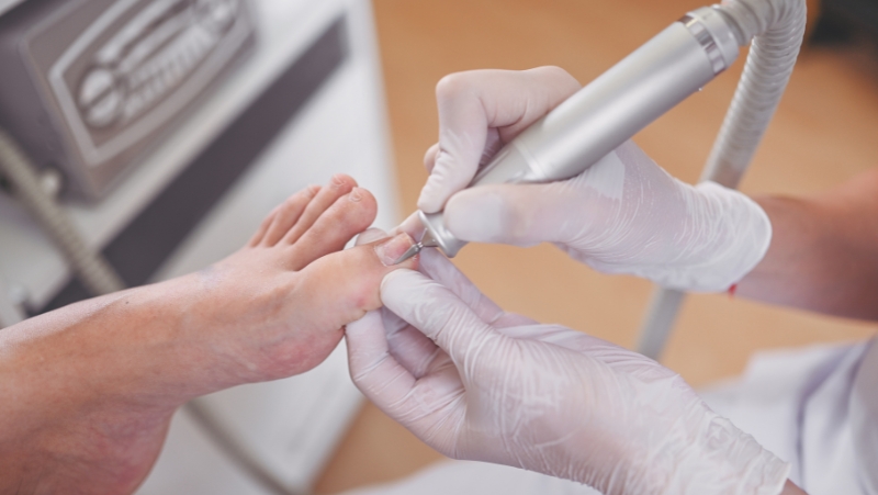 Podologe führt eine medizinische Nagelpflege durch.